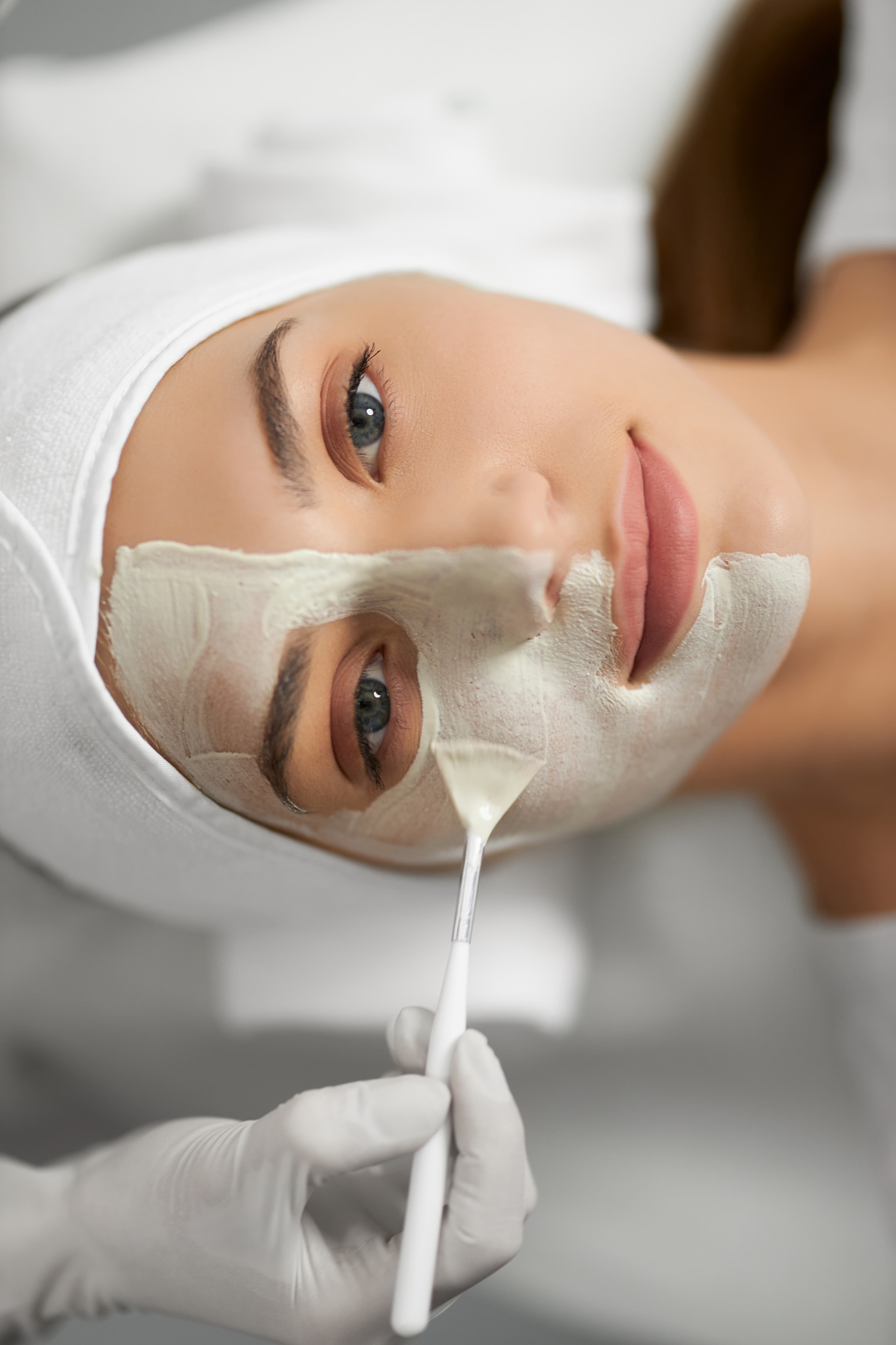 Peeling Químico